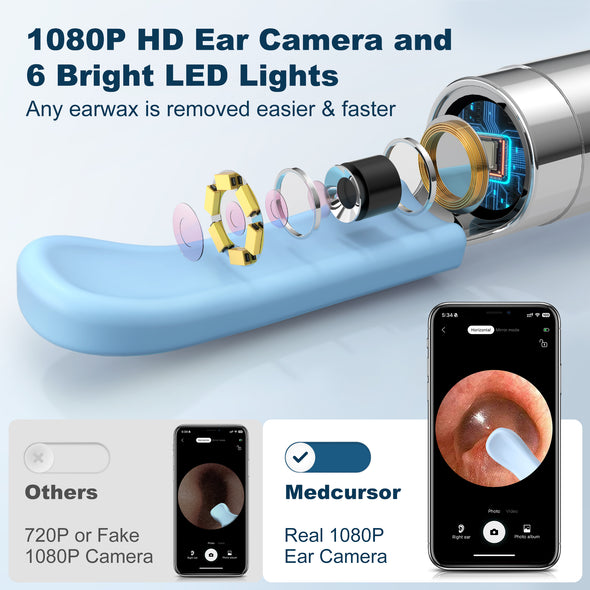 Medcursor Ear Wax Removal, Ear Wax Removal Tool Camera with 1080P HD Smart Visual Otoscope, Ear Cleaner with 6 LED Lights and 6 Soft Ear Scoops for iOS & Android