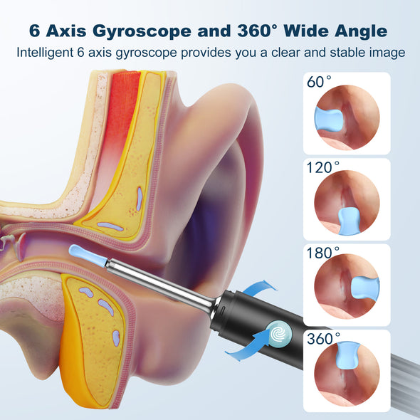 Medcursor Ear Wax Removal, Ear Wax Removal Tool Camera with 1080P HD Smart Visual Otoscope, Ear Cleaner with 6 LED Lights and 6 Soft Ear Scoops for iOS & Android